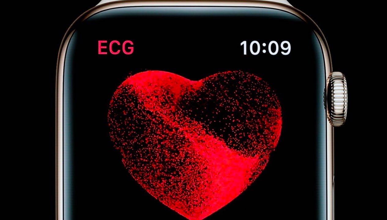 Apple Watch Ecg1