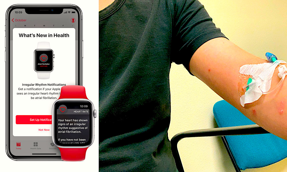 Apple Watch Saves Another Life
